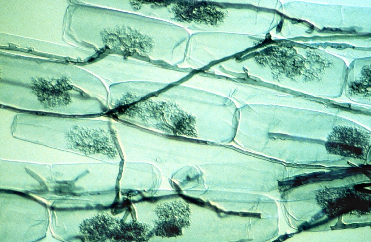 extant-arbuscules-in-endomycorhizae